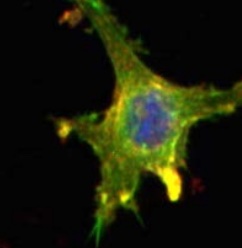 cancer cellmorphology